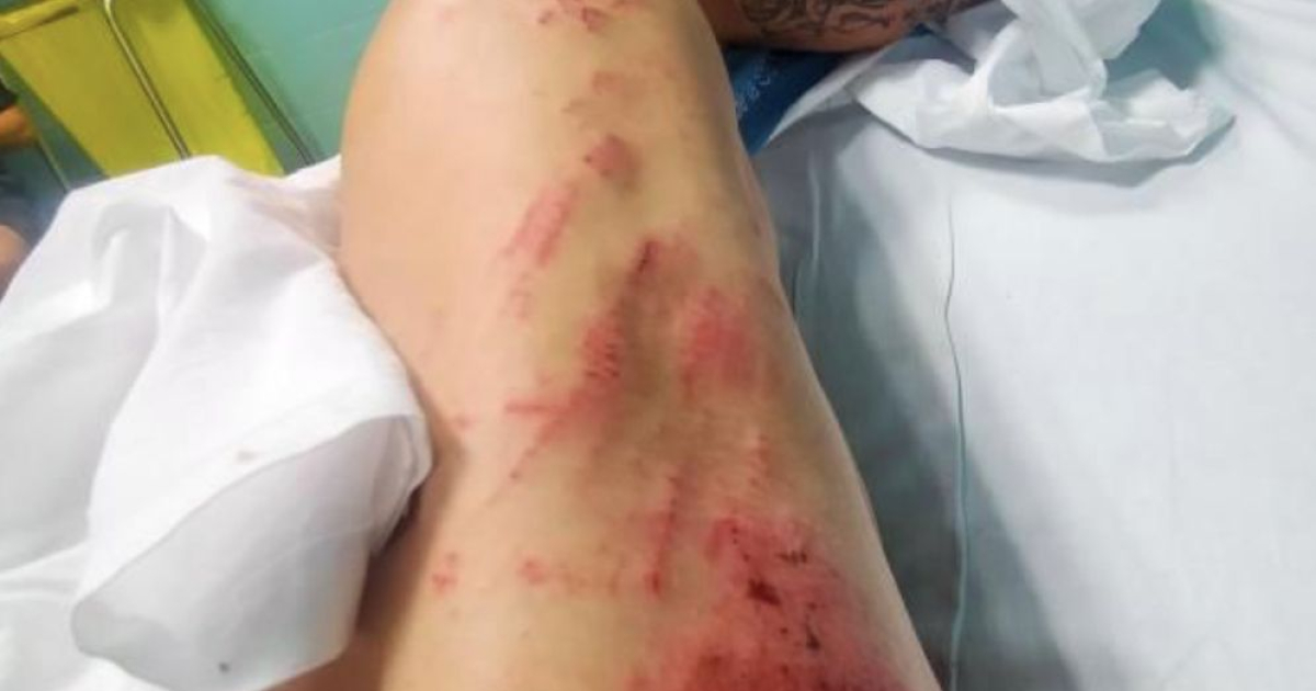 Un ciclista de Tàrrega, con contusiones tras ser arrollado por un vehículo