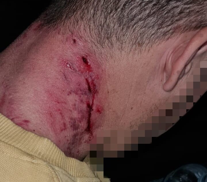 Hombre mordido por perro peligroso: El dueño enfrenta múltiples infracciones