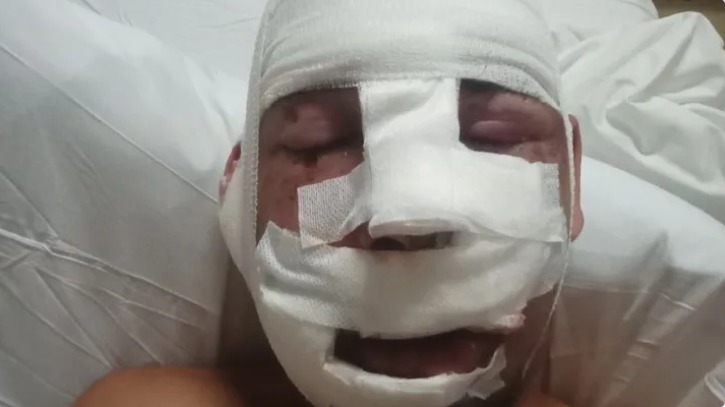 Un profesor onubense hospitalizado en Bali pide auxilio para curarse y poder volver a España