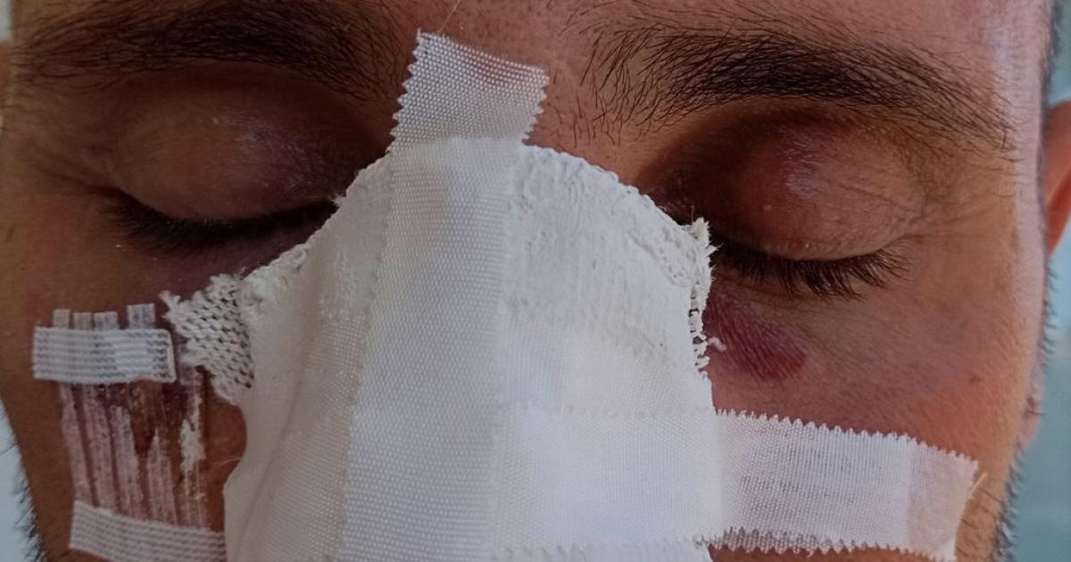 Un preso de Lledoners rompe la nariz a un funcionario leridano