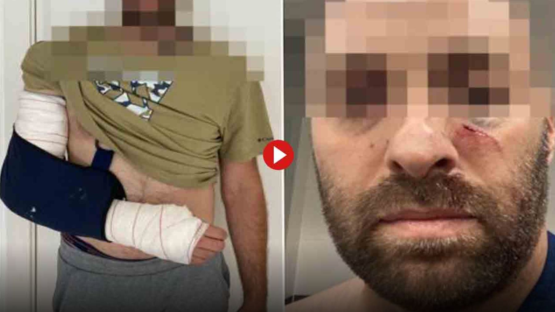 Brutal paliza a un taxista de Mallorca por parte de unos estafadores que se hacían pasar por sordomudos