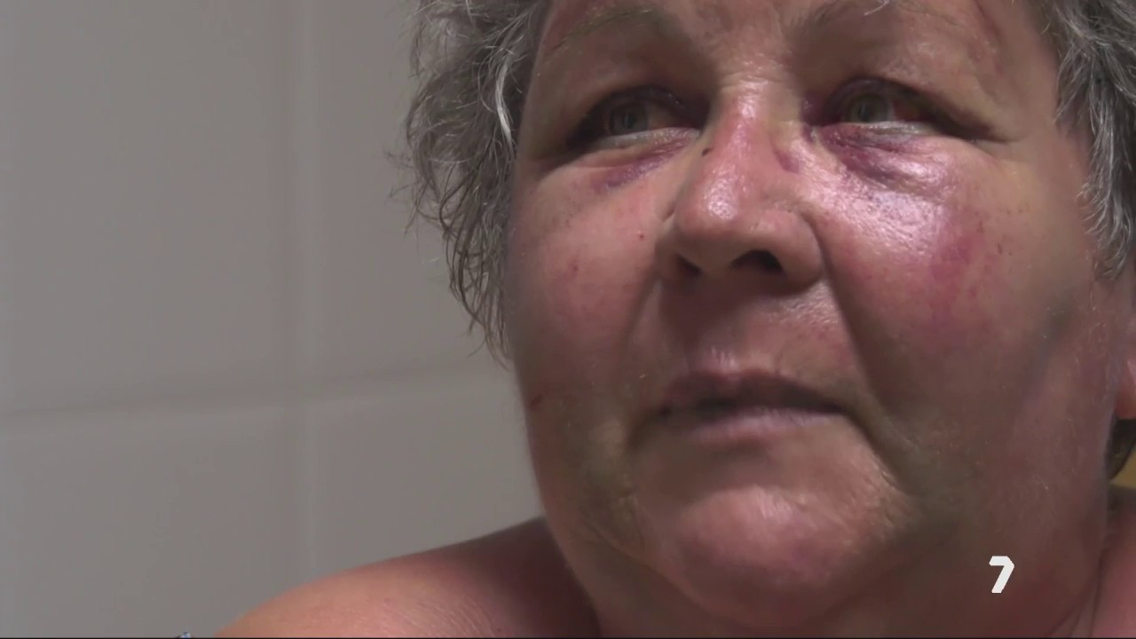 La brutal paliza para robar a Antonia en Puerto Lumbreras: "Pensé que me mataba"