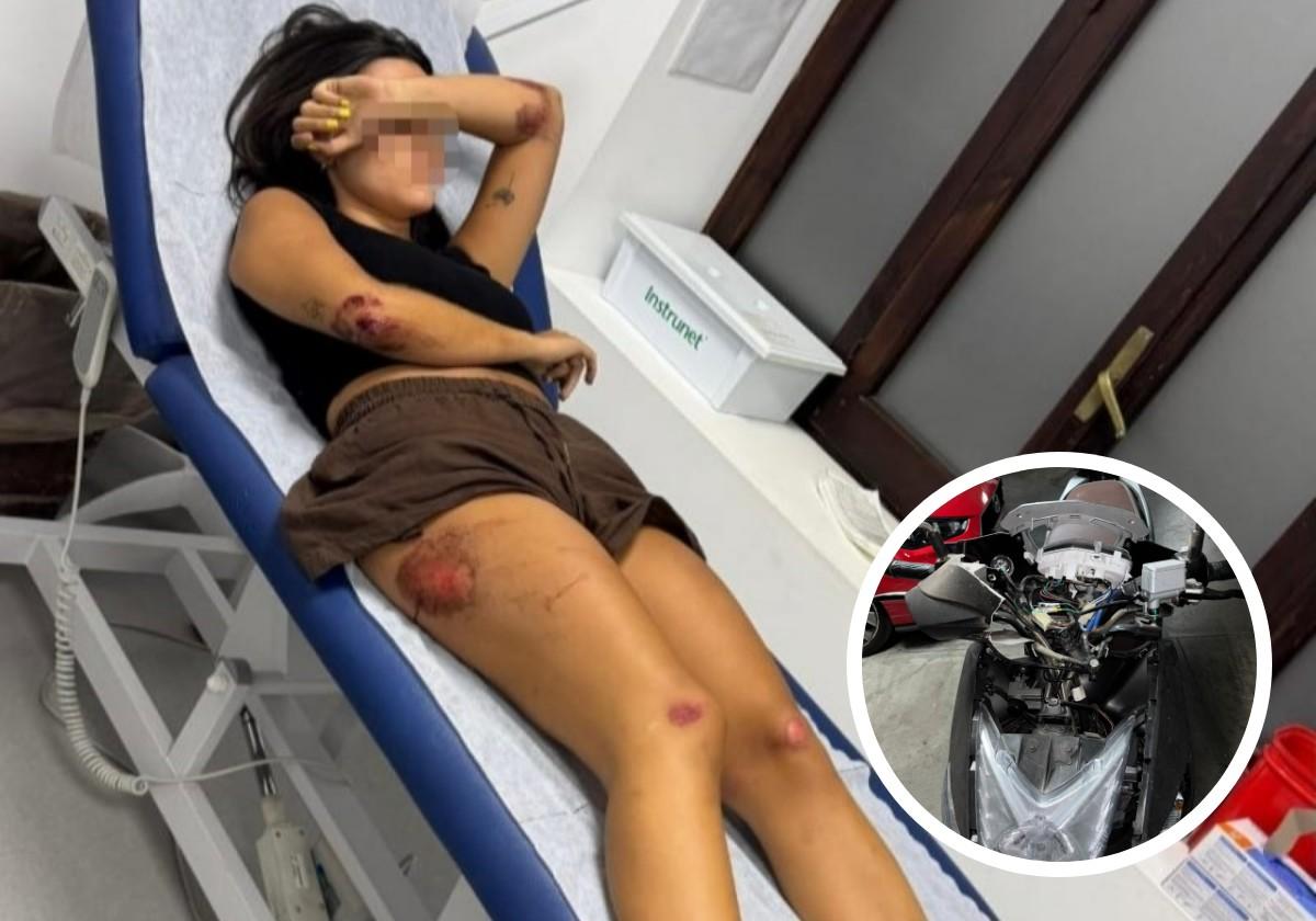 Denuncian el accidente de una joven de 27 años tras chocar su moto con un jabalí en Cerrado de Calderón