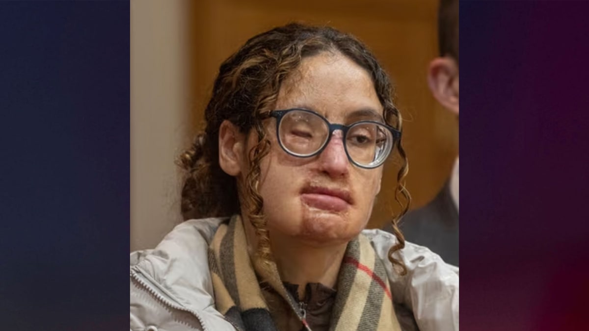 Aspiring rapper charged in connection with 2021 acid attack on college student