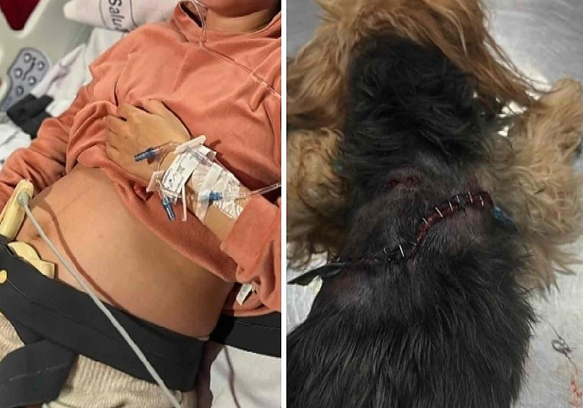 Un pitbull ataca a una embarazada y su mascota en Telde