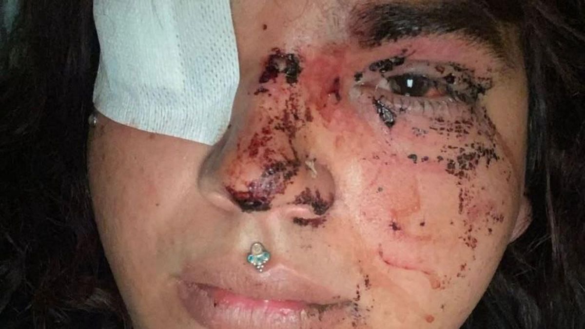 Detalle de la agresión sufrida por la víctima, que ha dado a conocer en redes sociales.