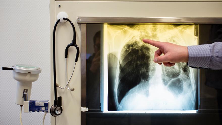 Detectan un brote de tuberculosis entre el personal del Instituto de Medicina Legal de Toledo