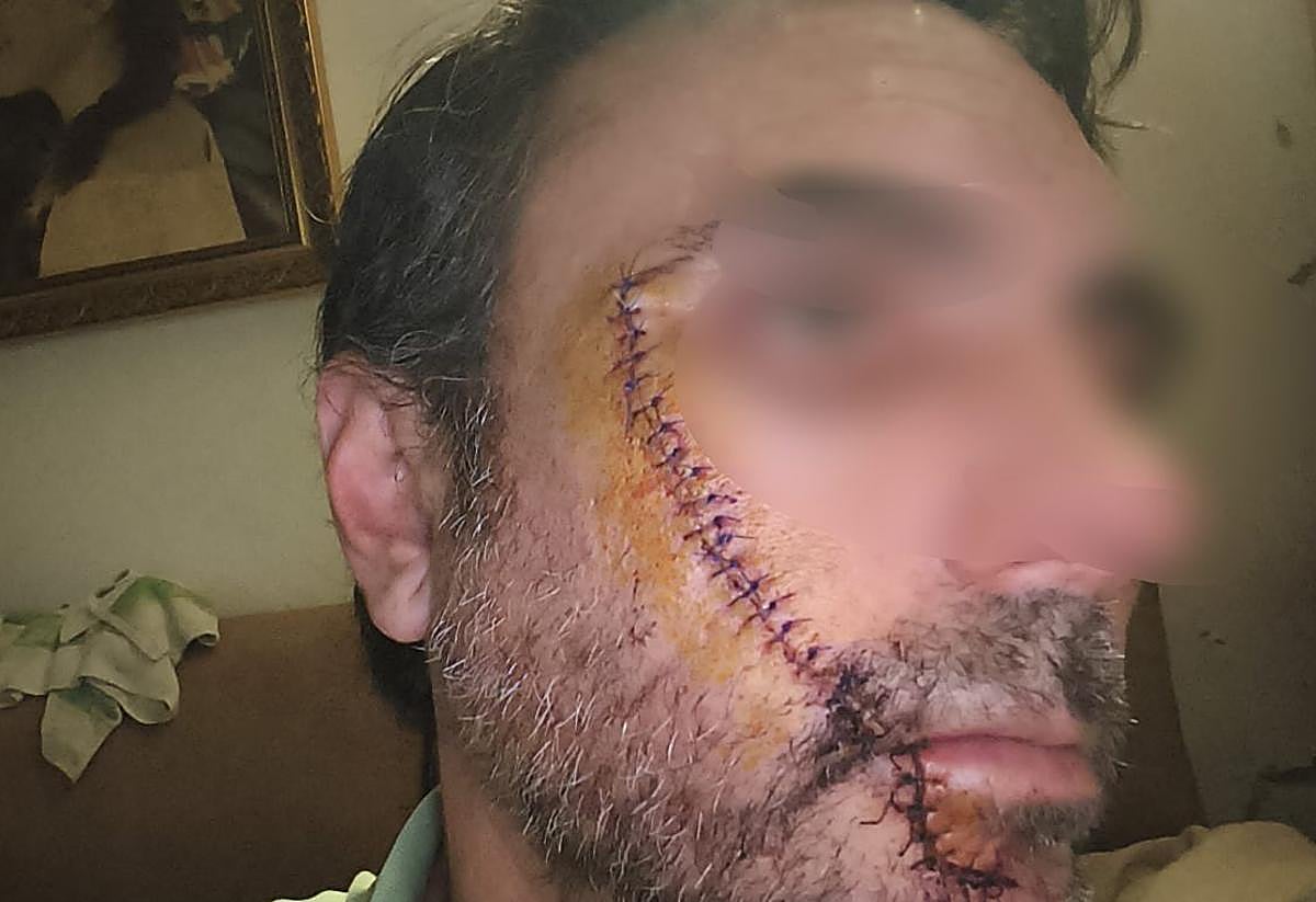 Jorge, el hombre al que rajaron la cara en Málaga: «Si no llego a ver el reflejo del cuchillo, me mata»