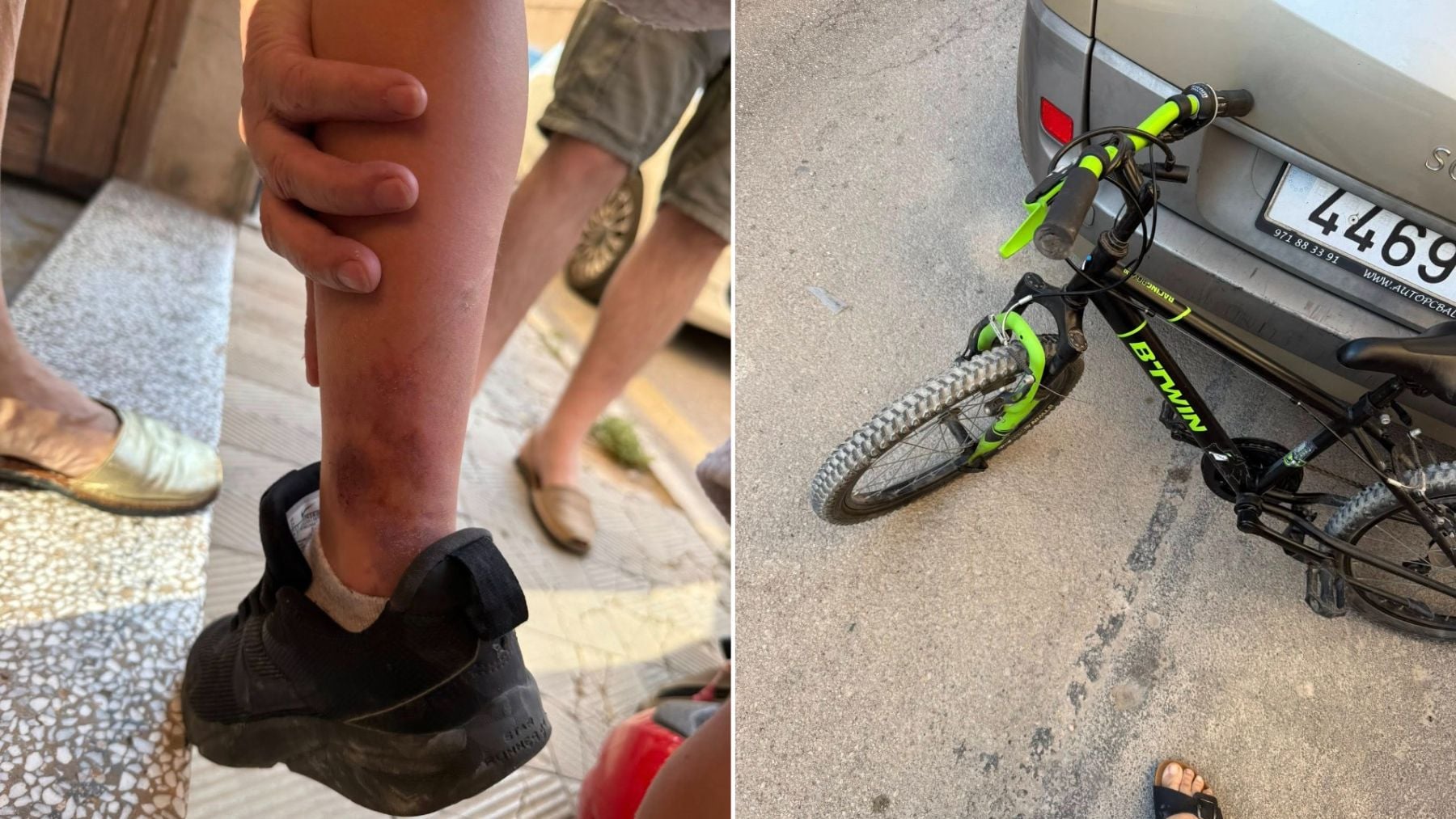 Un niño es arrollado cuando iba al colegio en bicicleta en Llucmajor: la conductora se detiene, le aconseja hielo y se va