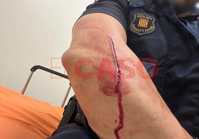 Agente de los Mossos d’Esquadra resulta herido grave durante intervención policial en Vic