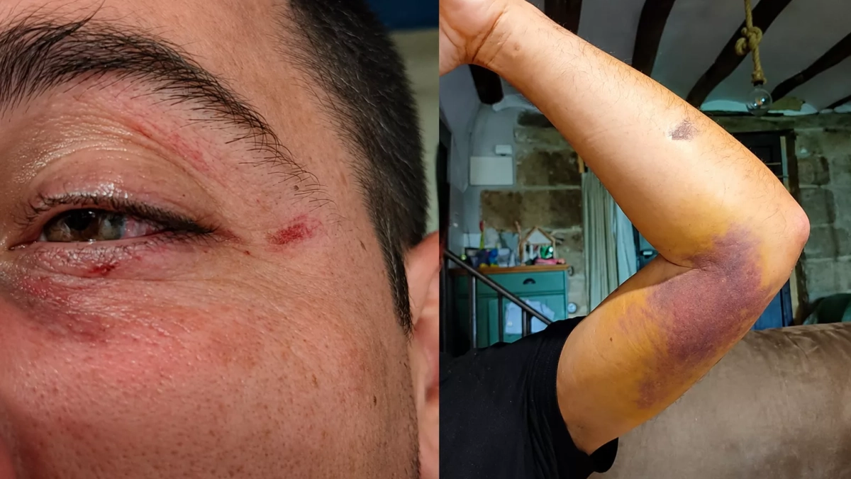 Dos víctimas hablan para evitar nuevas agresiones en Huesca: "Queremos que esto pare"