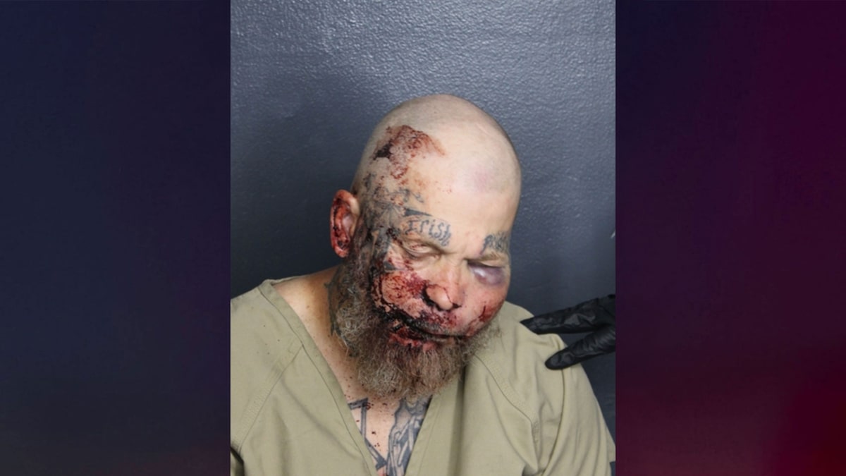 Hombre de 51 años arrestado en hospital de Florida tras desafiar a un policía a pelear