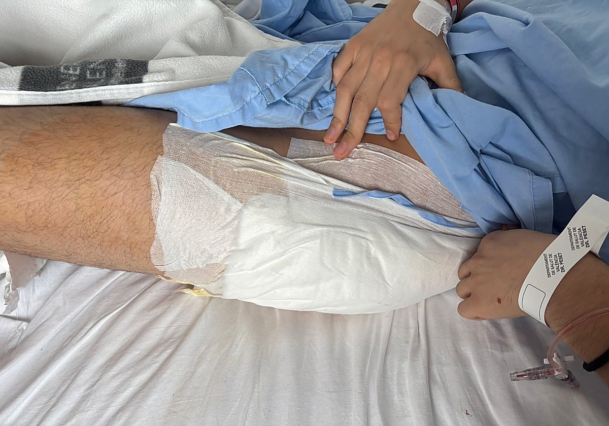 Joven de 18 años herido de gravedad tras ser atacado por banda latina en Valencia durante un violento robo